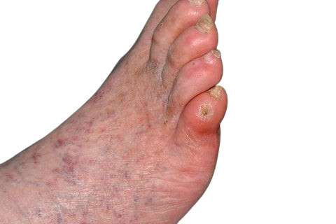 Medical grade manuka honey